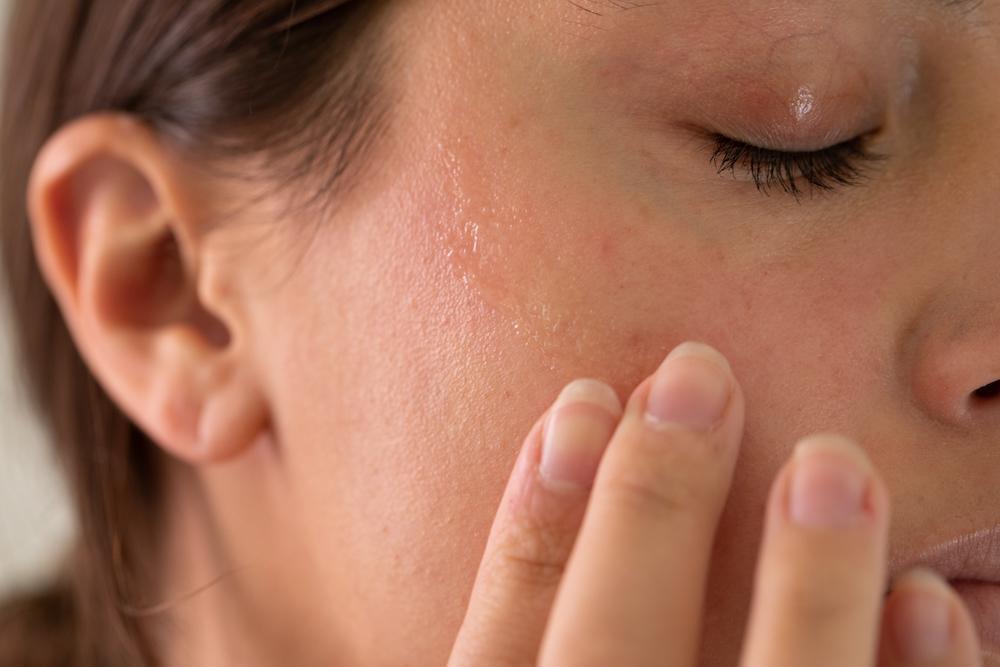 A Miracle Oil for Dry, Tight, Flaky Skin